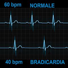 Monitorare il Battito Cardiaco per Ottimizzare ​le performance Fisiche